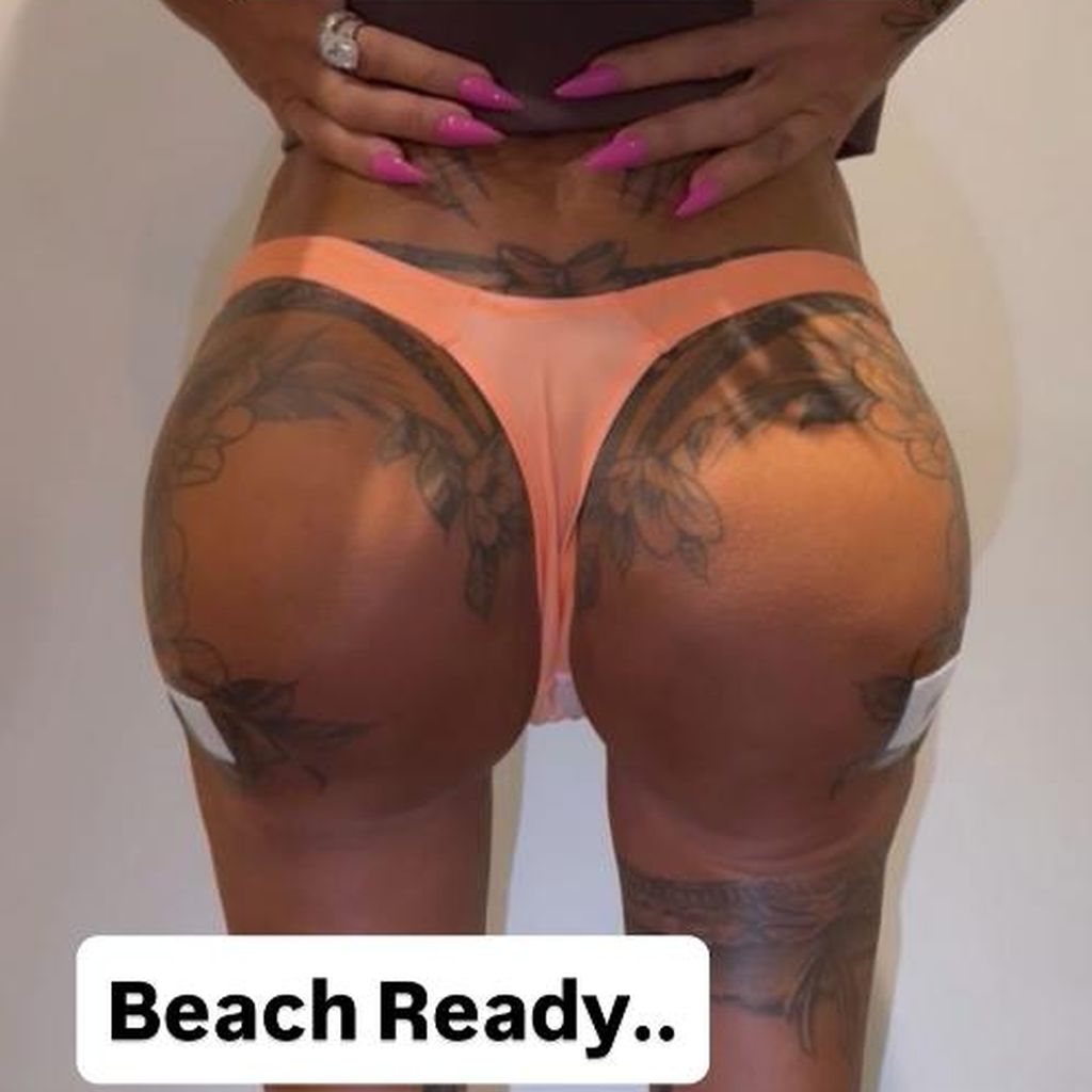 It-Girl Katie Price präsentiert ihren Hintern nach einer OP.