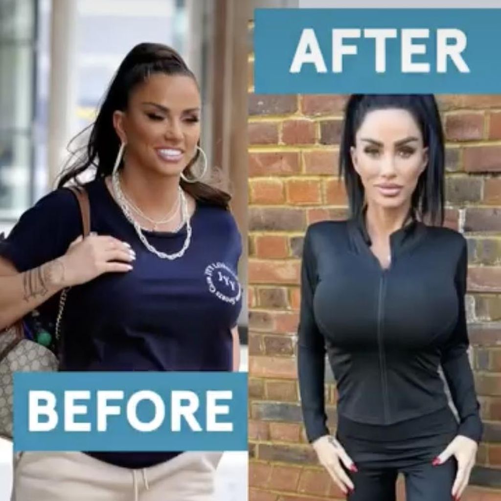 Katie Price, 2021 vs. 2026