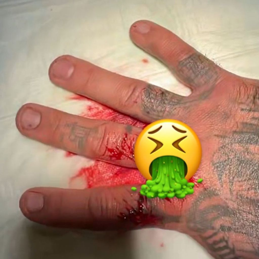 Kontra Ks Hand