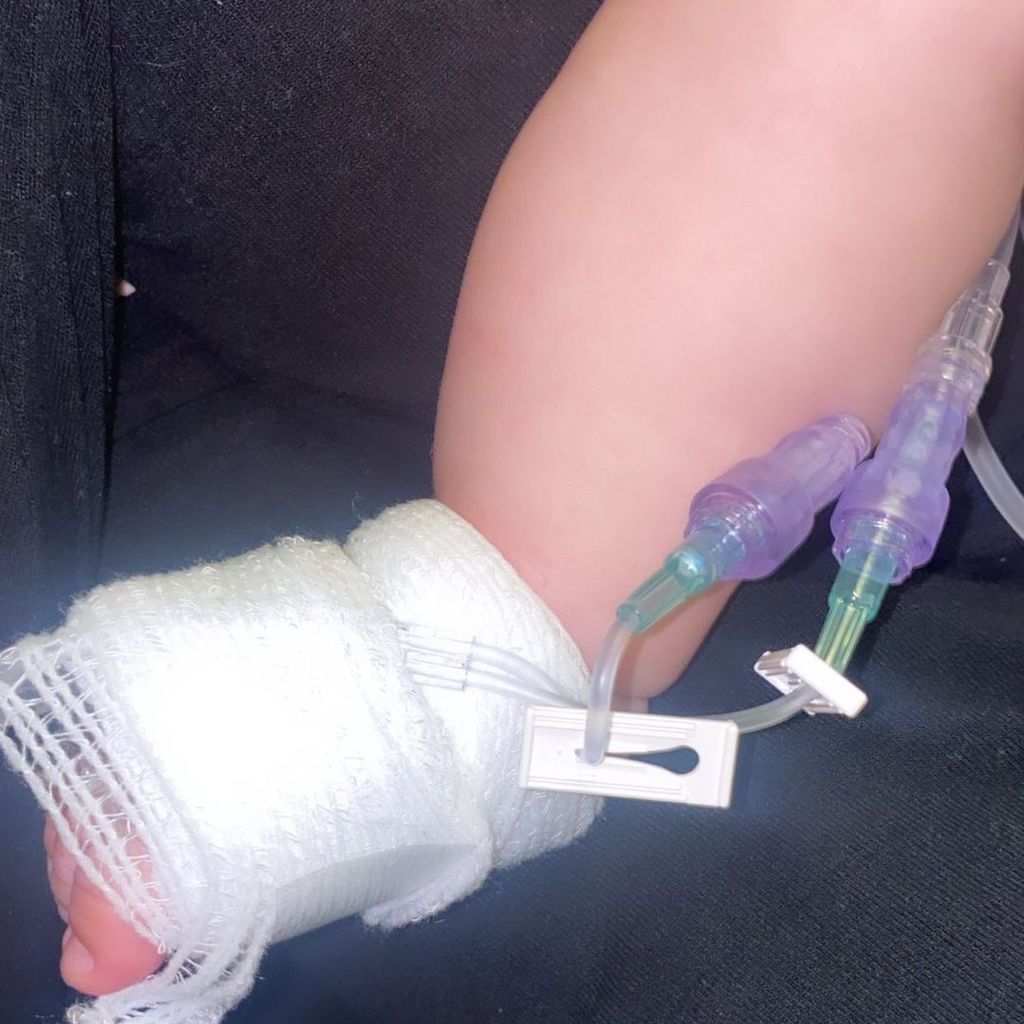 Fuß von Lauren Goodgers Tochter im Krankenhaus