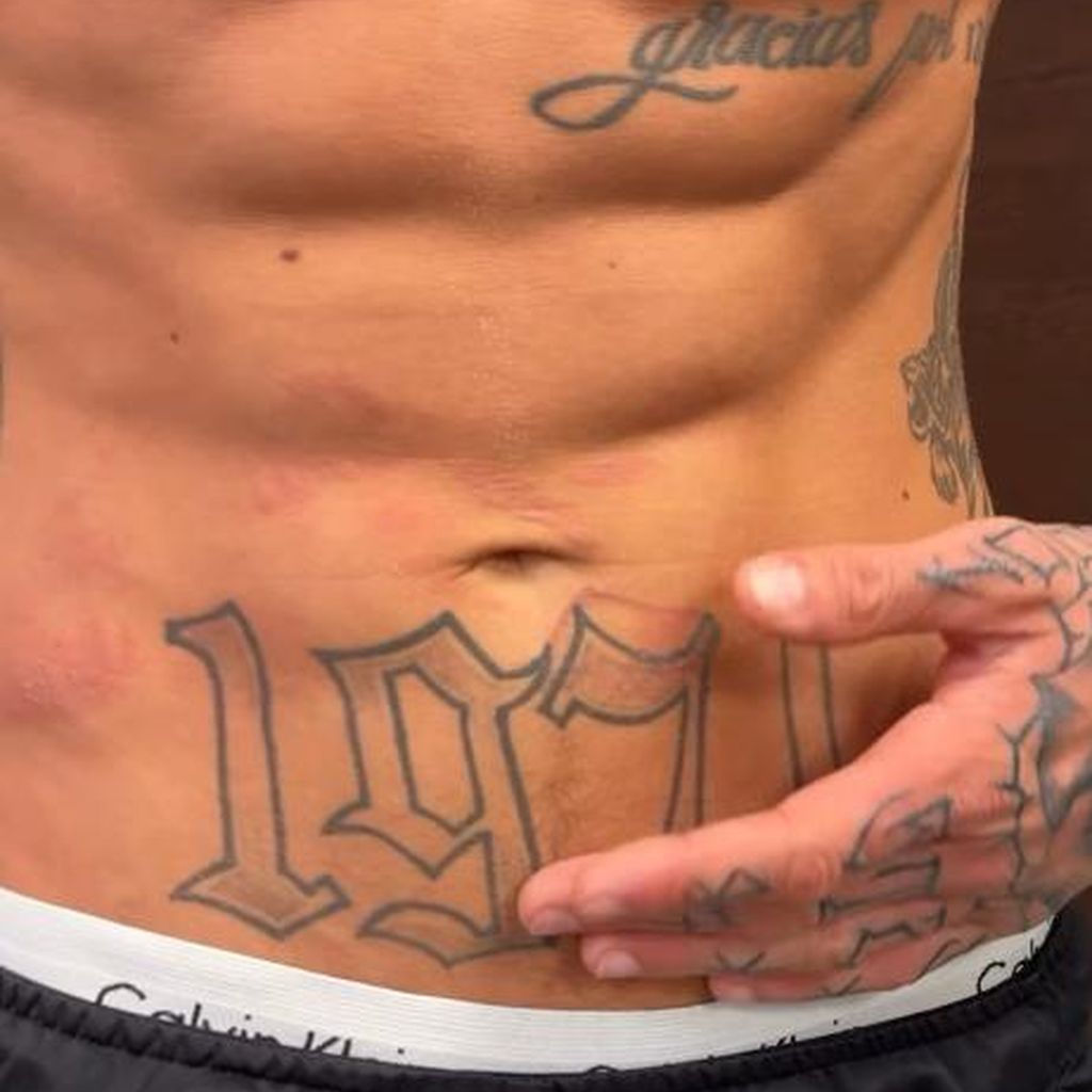 Laurenz Peschs Verbrennungen nach dem Stunt, Januar 2026