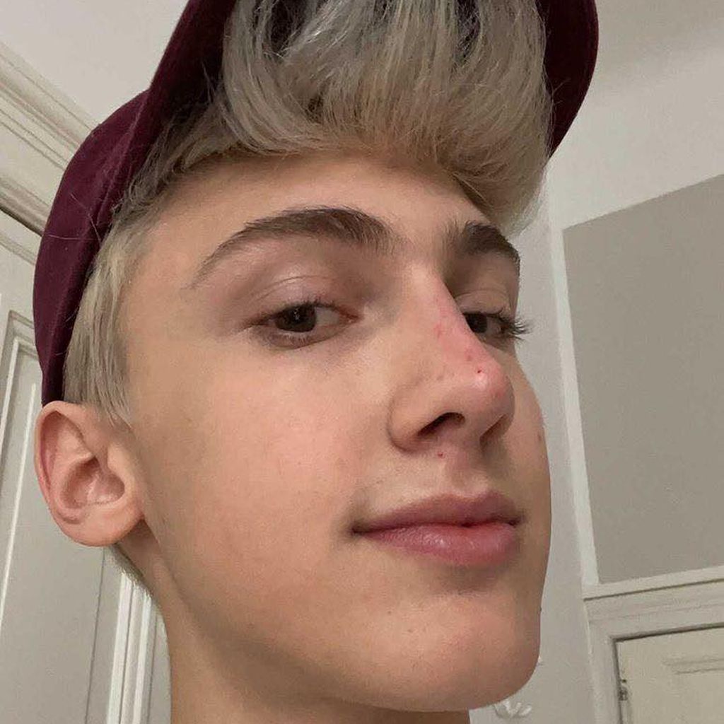 Leon Content, nach einem Beauty-Eingriff