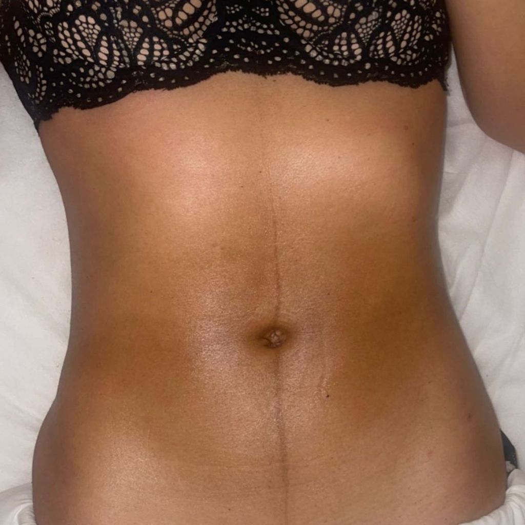 Liliana Matthäus zeigt ihren After-Baby-Body
