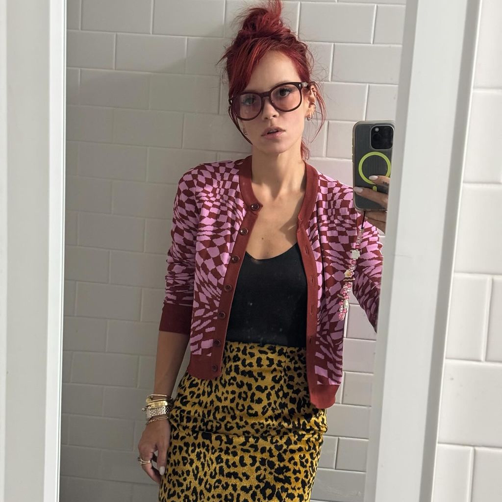 Lily Allen vor ihrer Brust-OP
