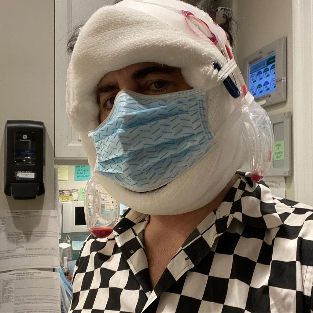 Marc Jacobs nach seinem Facelifting, Juli 2021
