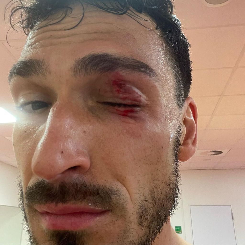 Mats Hummels, Fußballspieler