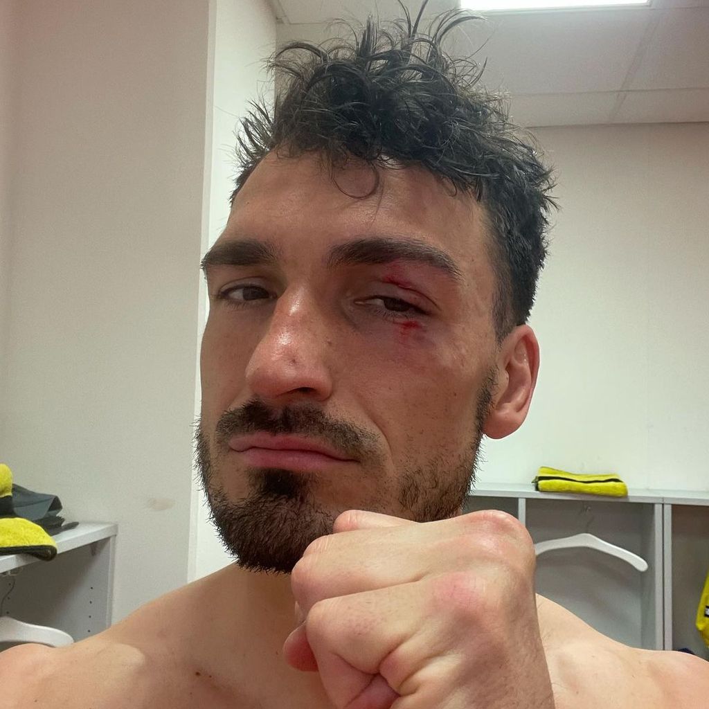 Mats Hummels ist verletzt