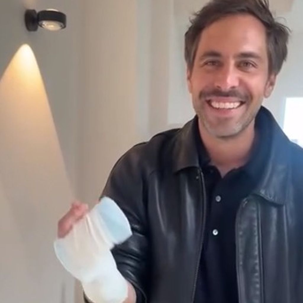 Max Giesinger trägt nun einen Gips am Finger