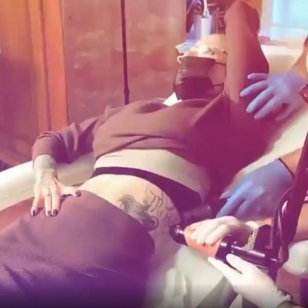 Melanie Müller bei ihrer Laser-Sitzung