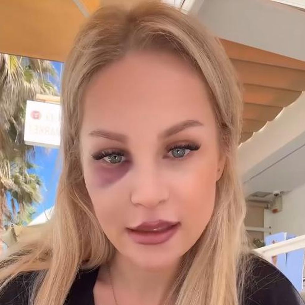 Michelle Schellhaas