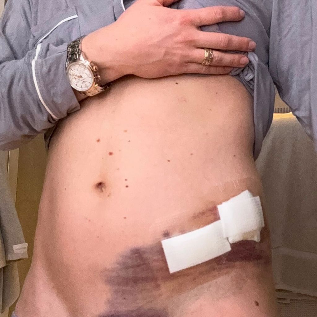 Mikaela Shiffrin nach einem Skiunfall