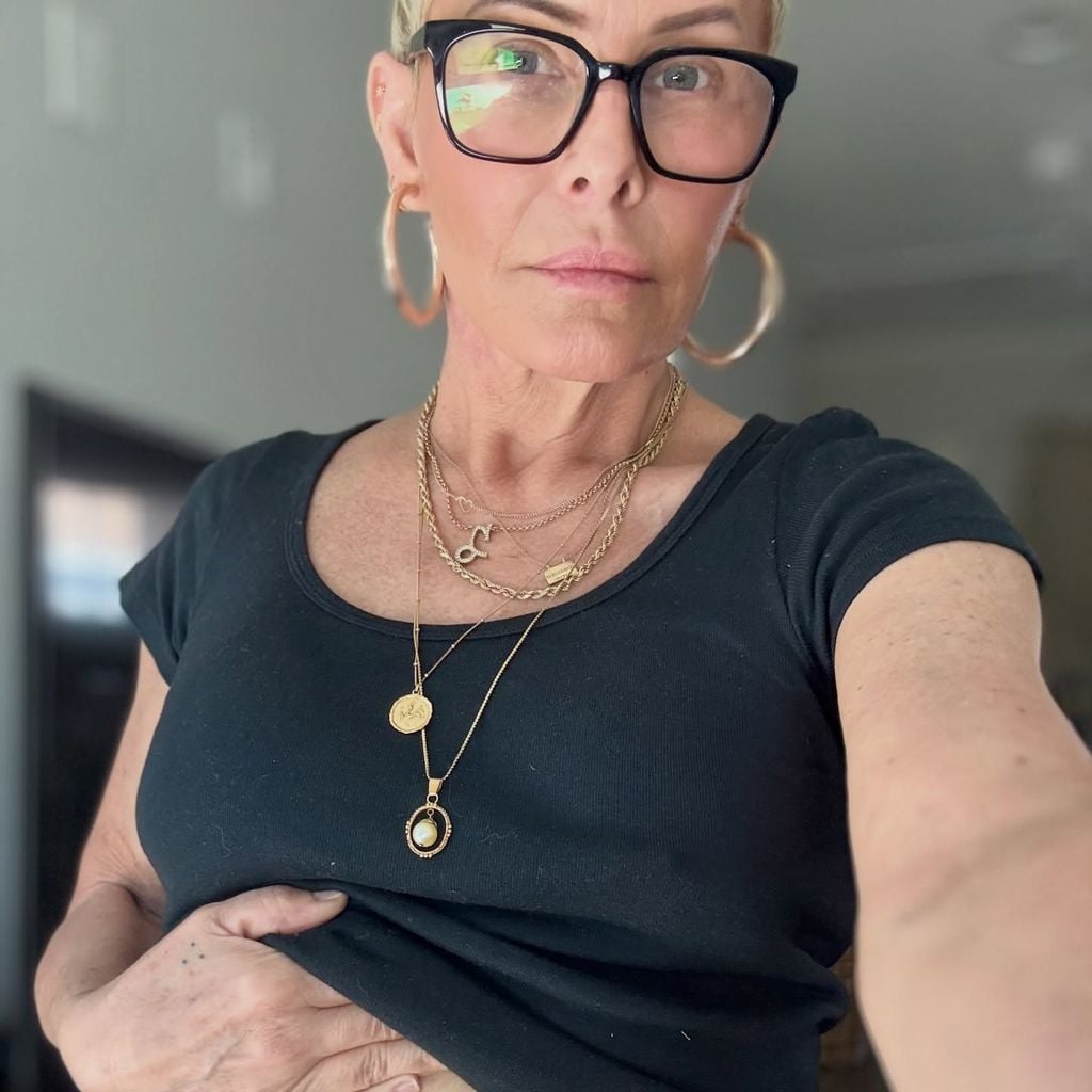 Nicole Eggert nach ihrer OP