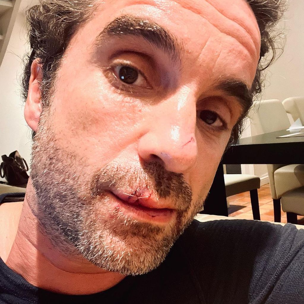 Oliver Wnuk mit seiner Verletzung