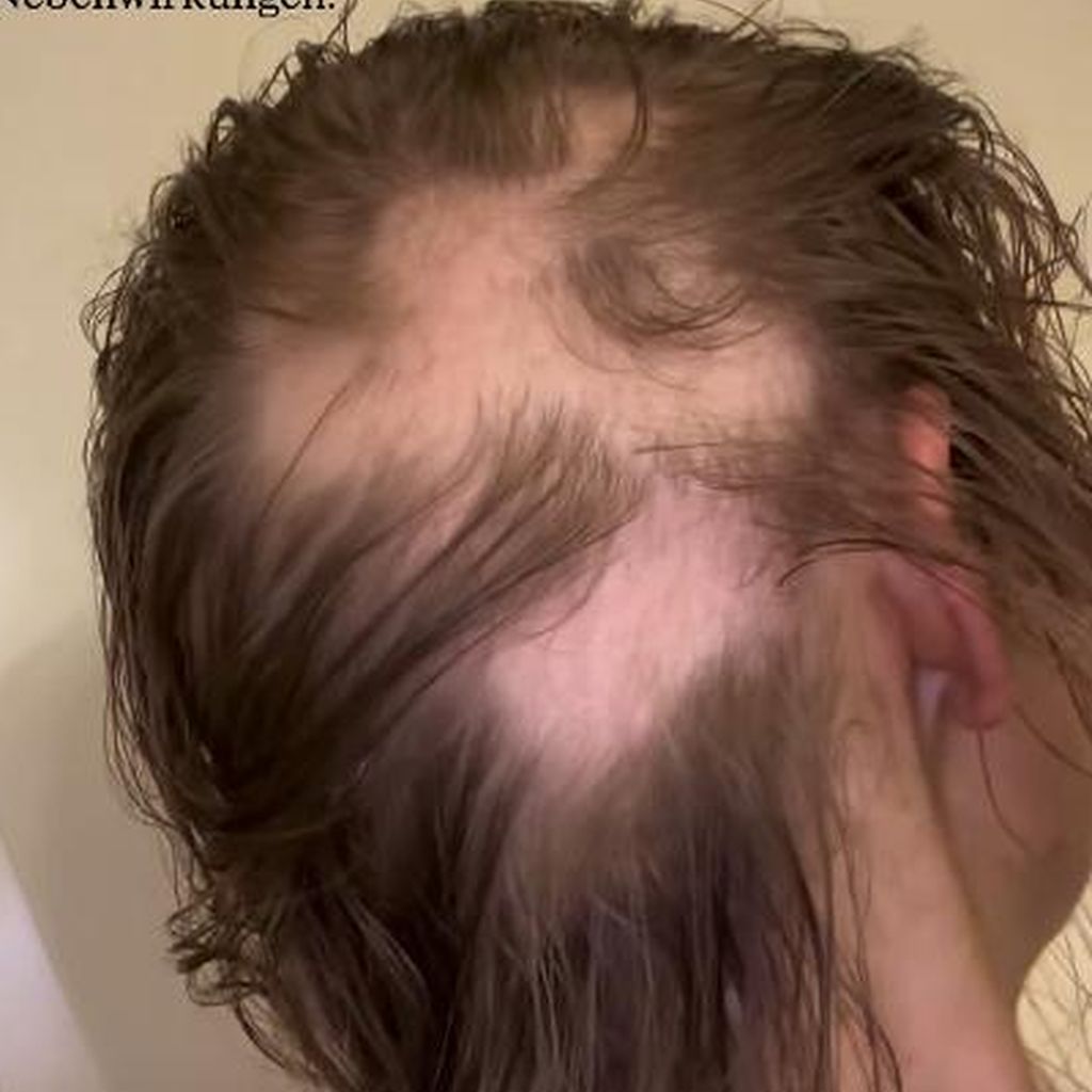 Patrice Aminati, Januar 2026