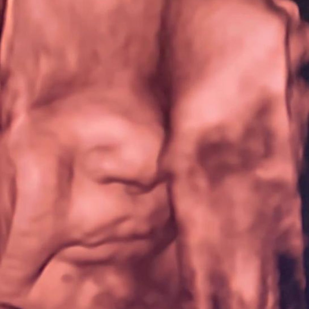 Philipp Stehler und Vanessa Ciombers Baby im 3-D-Ultraschall