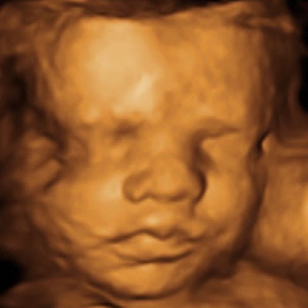 Philipp Stehler und Vanessa Ciombers Baby im 3-D-Ultraschall