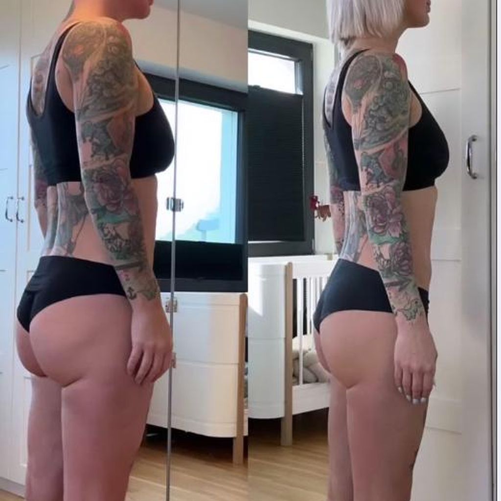 Pia Tillmann zeigt ein O.P.-Vorher-Nachher-Foto