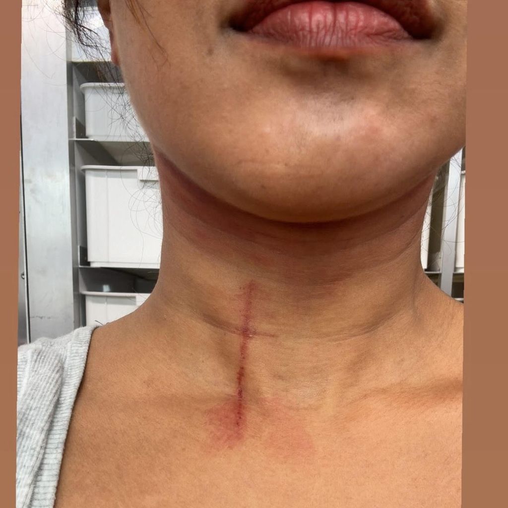 Priyanka Chopras Stuntverletzung beim Dreh von "The Bluff"