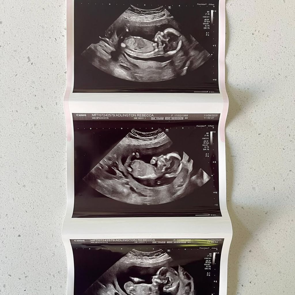 Rebecca Adlingtons postet das Ultraschallbild zur Schwangerschaft, 2025