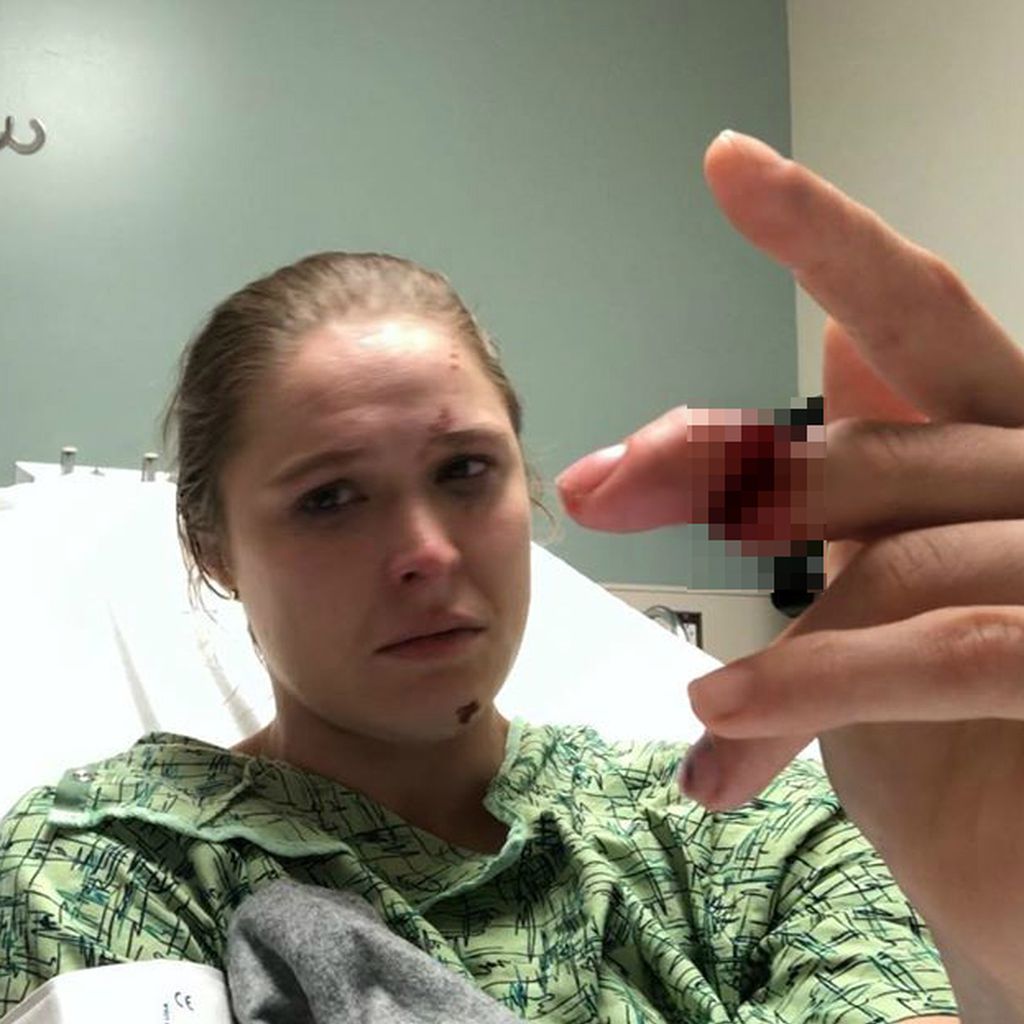 Ronda Rousey im Krankenhaus