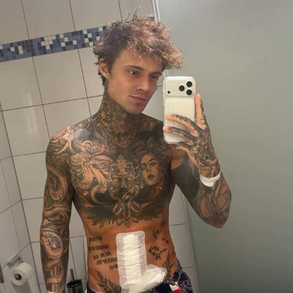 Samuel Dohmen nach seiner OP, April 2026
