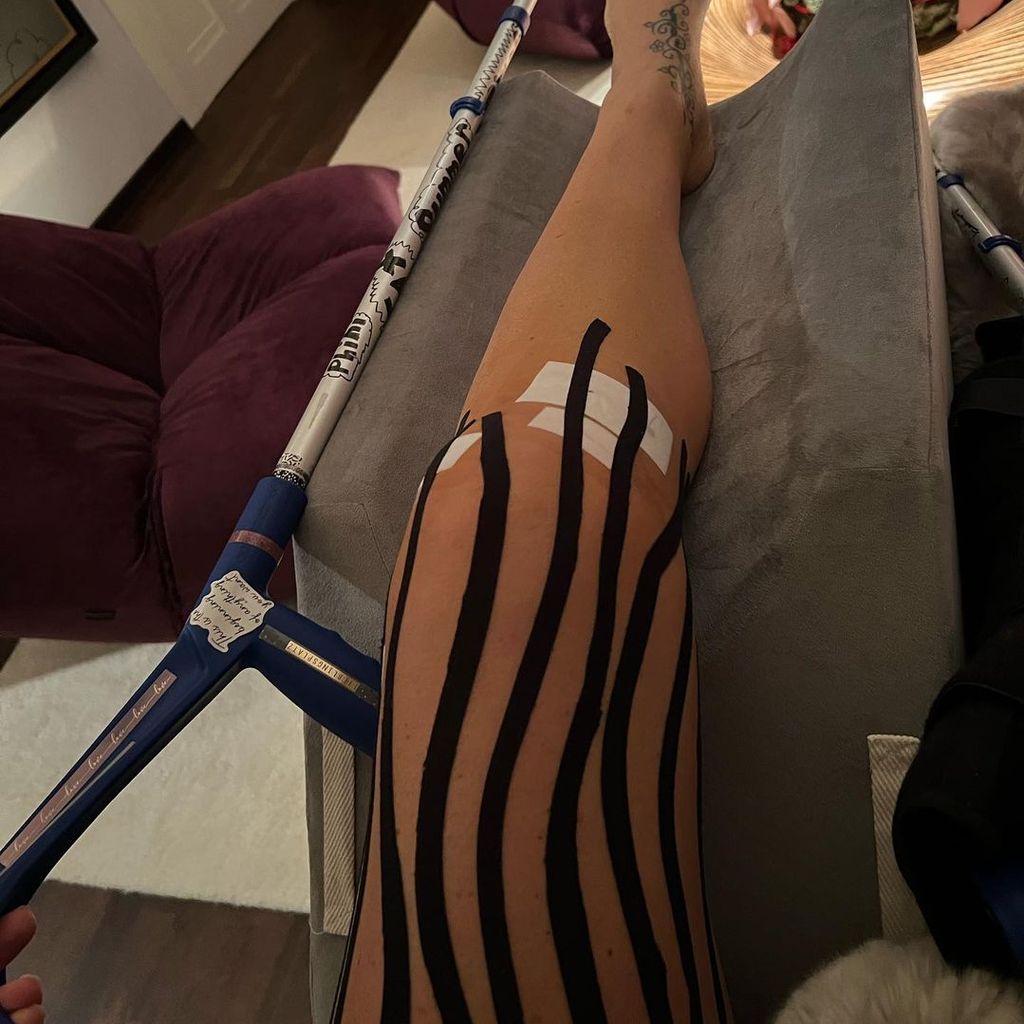 Sarah Connor mit ihrem verletzten Bein