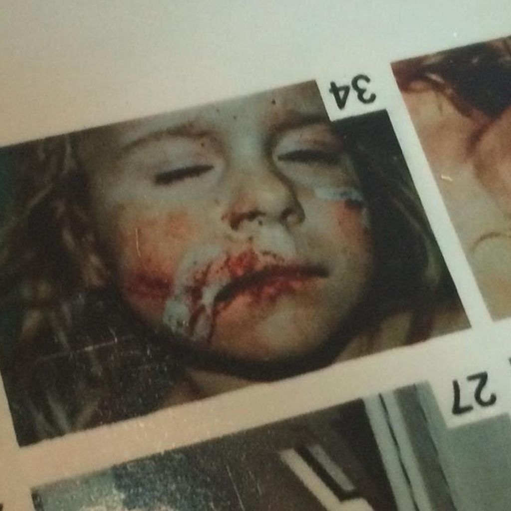 Sarah Franssen nach der Attacke von einer Katze