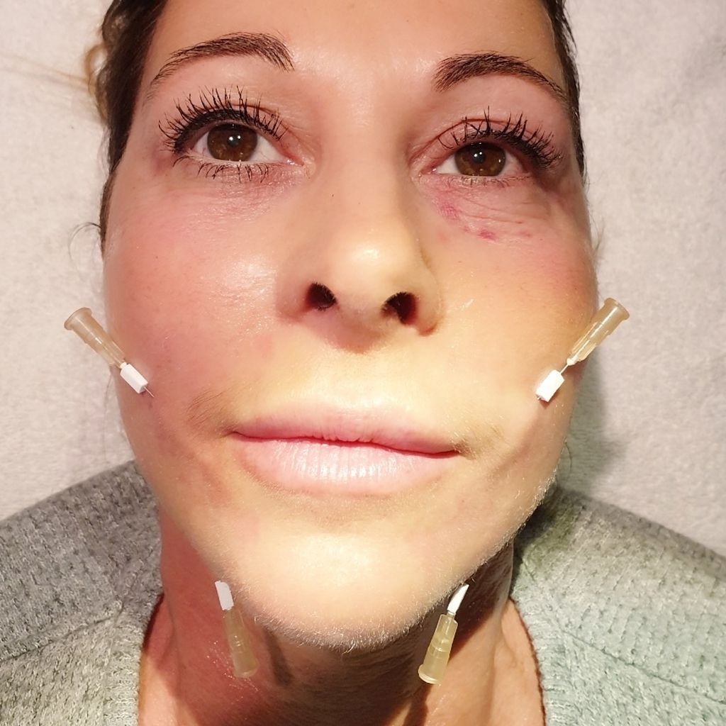 Schlagersängerin Marion "Krümel" Pfaff
