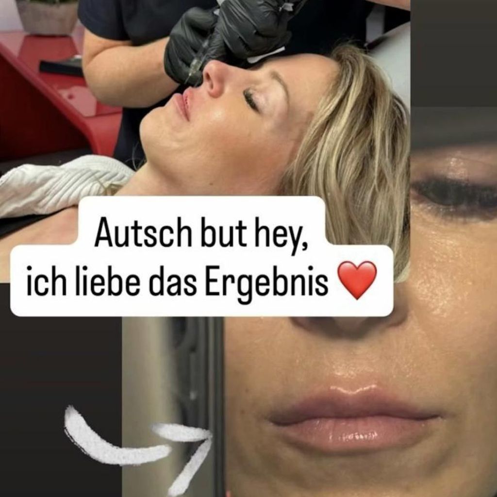 Simone Lugner nach Beauty-Eingriff, März 2026