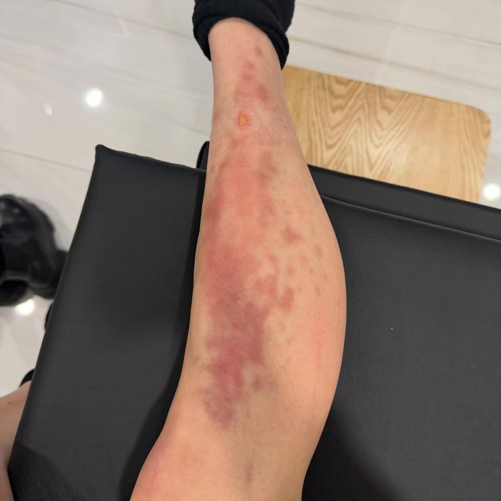 Taylor Momsens Bein, April 2026