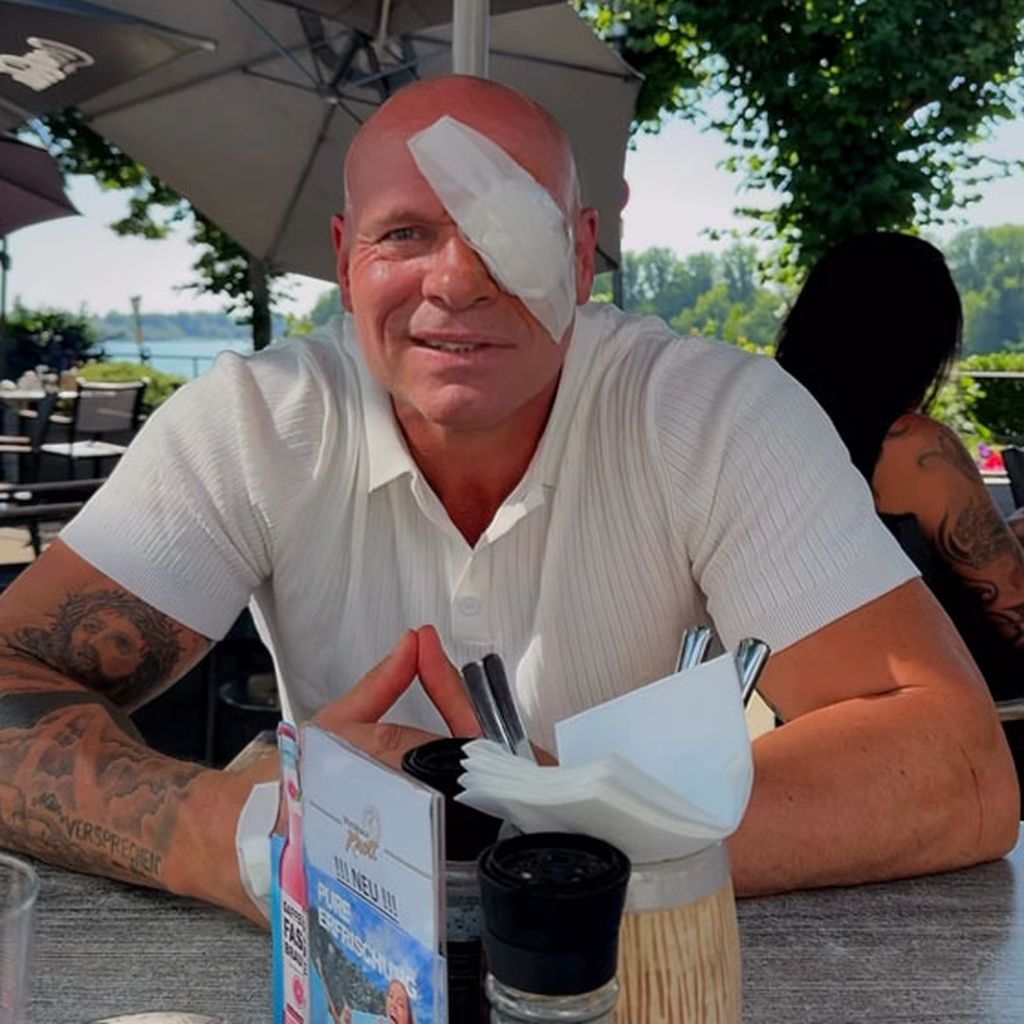 Realitystar Thorsten Legat nach seiner Augenoperation im August 2025
