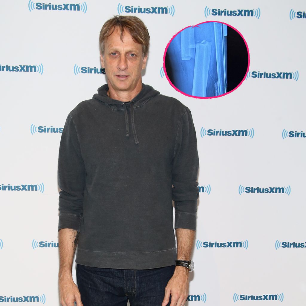 Tony Hawk, Skater