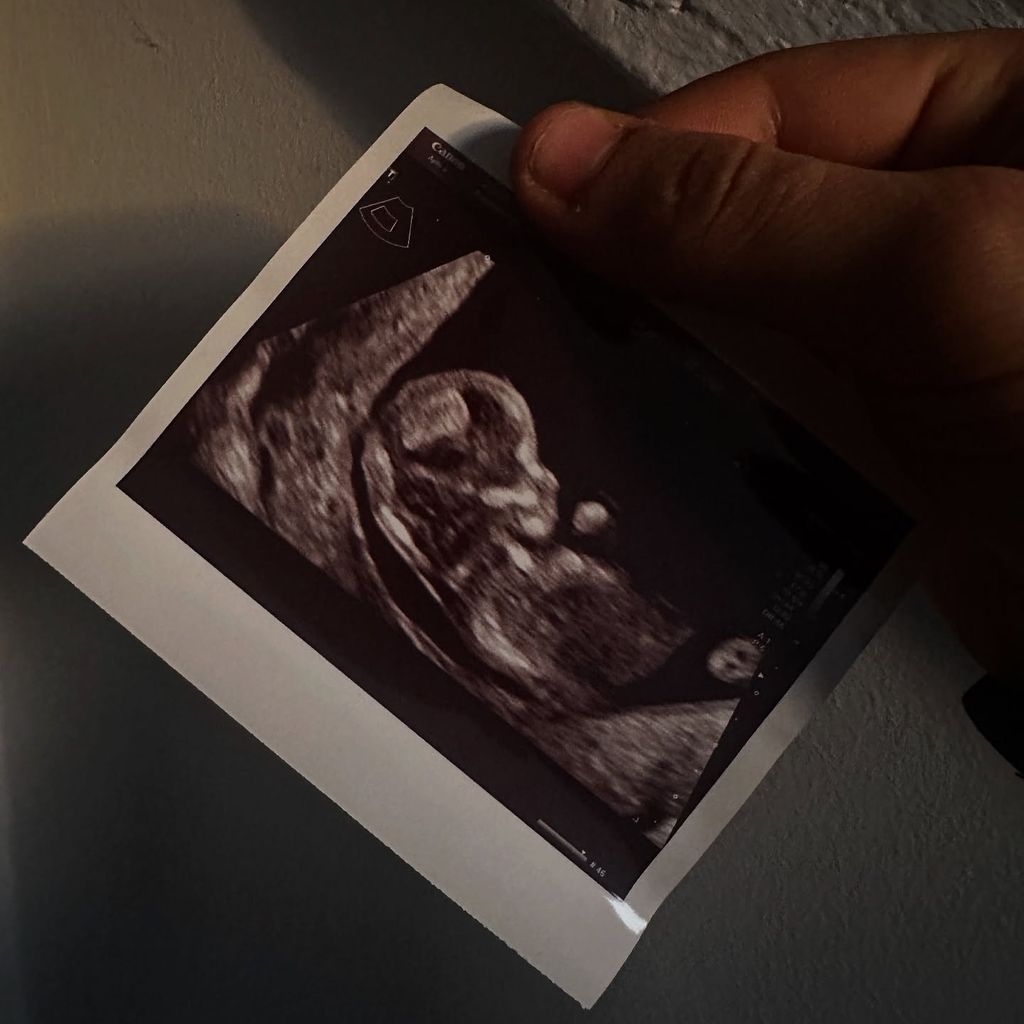 Ultraschallfoto von Alexander Runows Baby, Dezember 2024