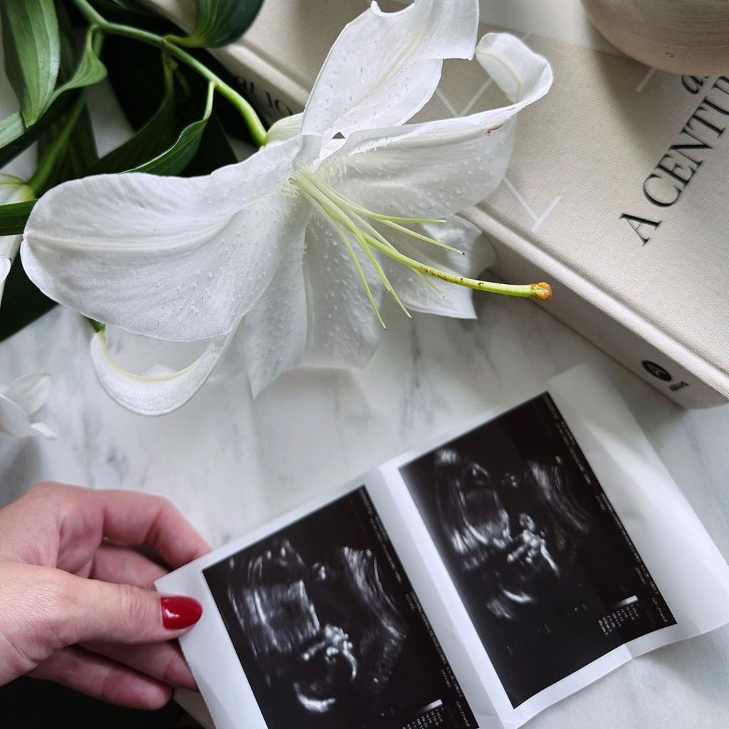 Ultraschall von Josh Duhamel und Audra Maris Baby