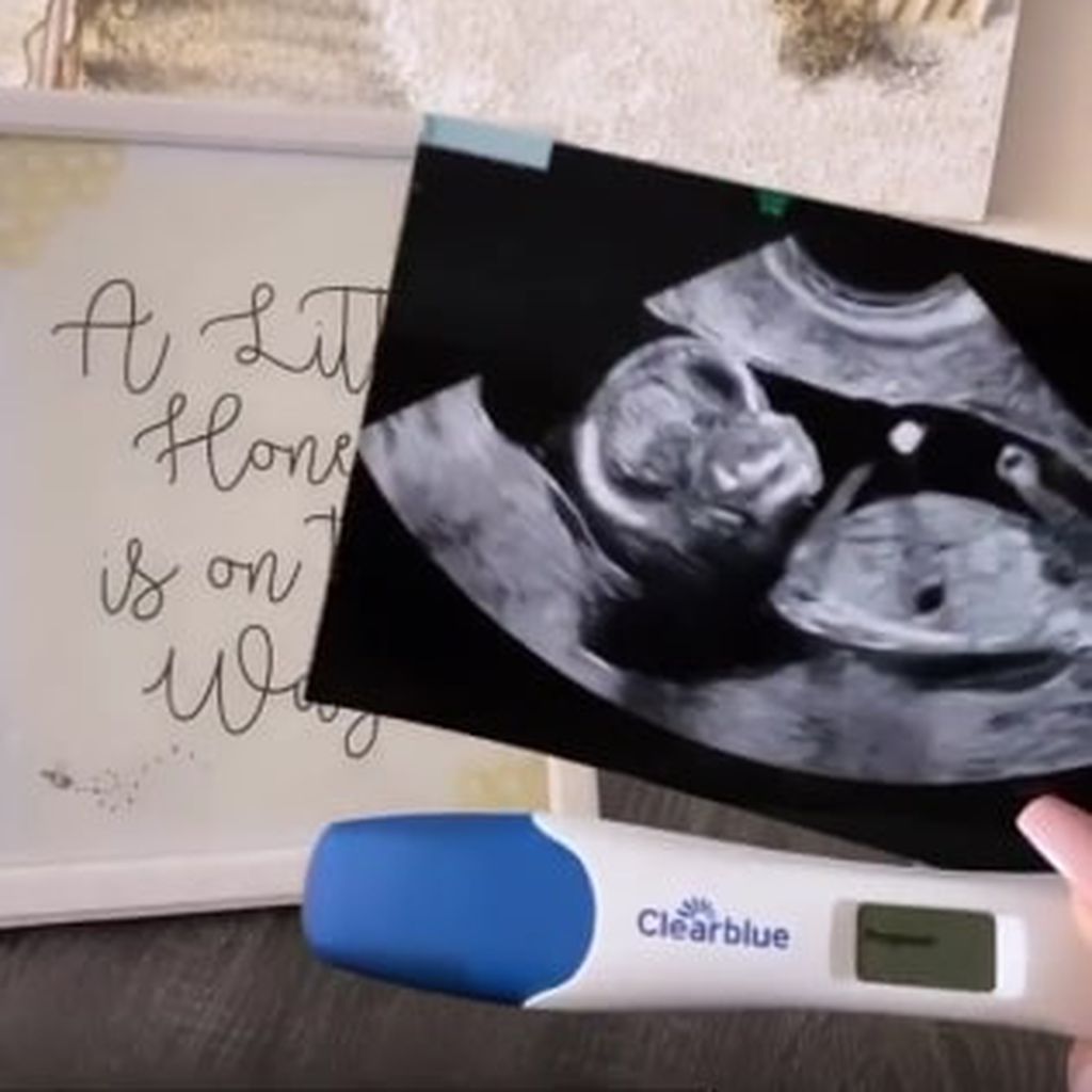 Ultraschallbild und Schwangerschaftstest von Scheana Shay