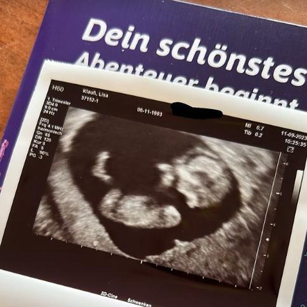Ultraschallbild vom Baby von Gzuz und seiner Frau Lisa