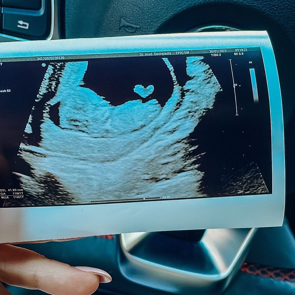 Ultraschallbild von Jan Leyks Nachwuchs, 2023