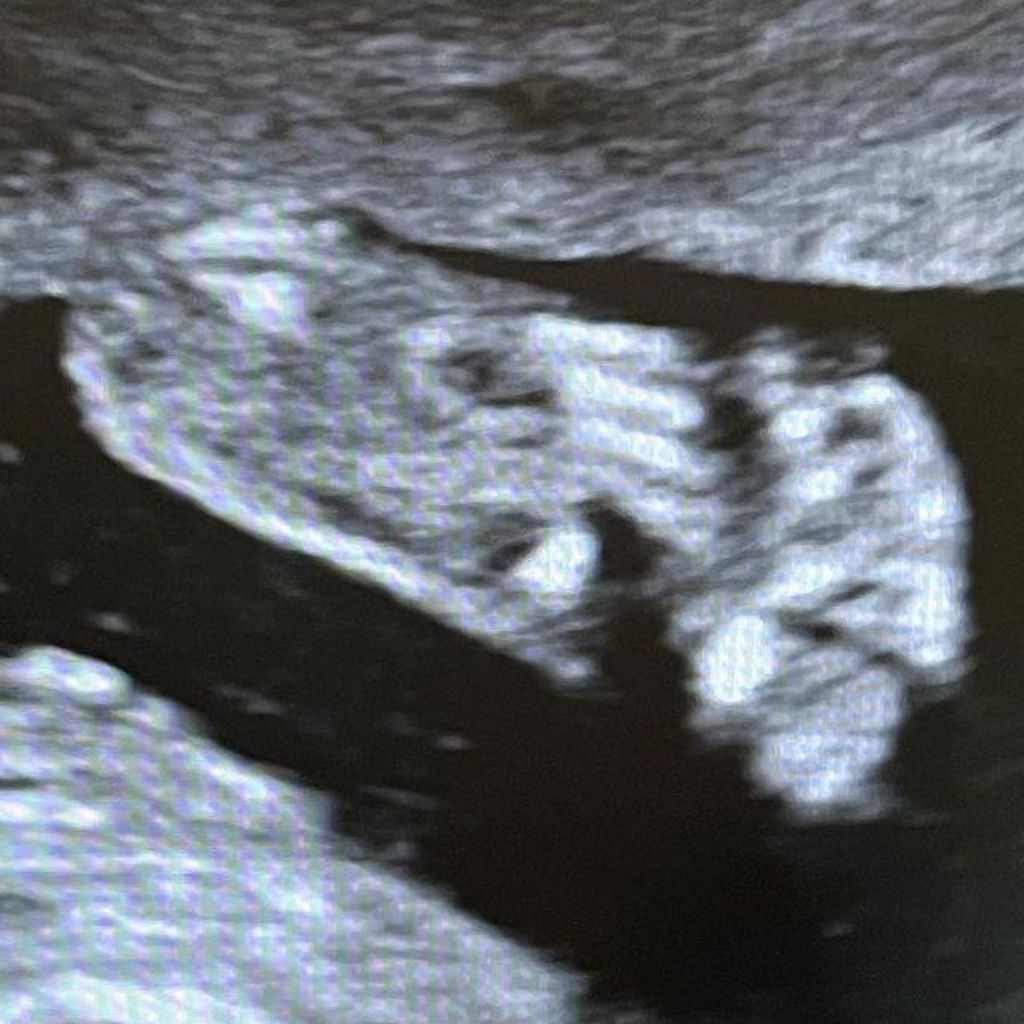 Ultraschallbild von Jessie Caves viertem Baby