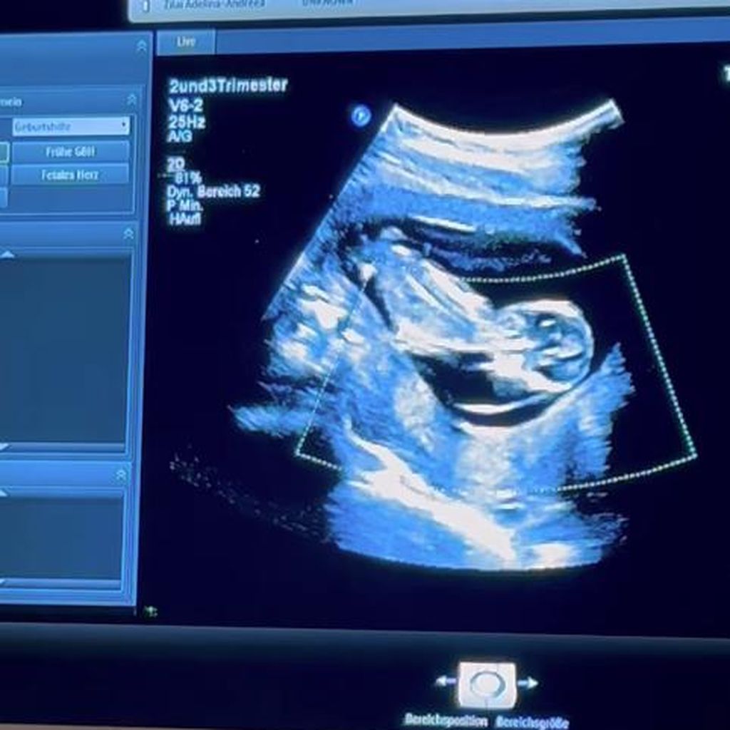 Ultraschallbild von Mola Adebisis Baby, 2024