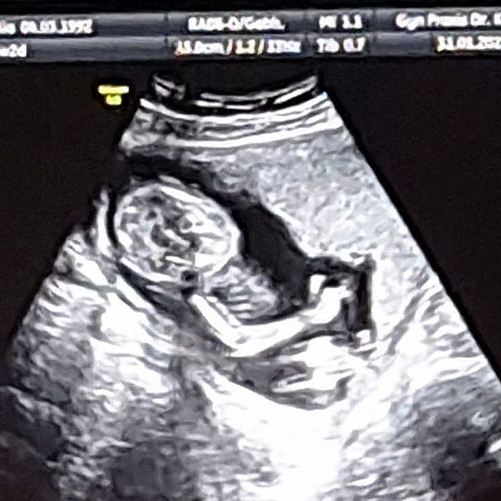 Ultraschallbild von Saskia Atzerodts Baby