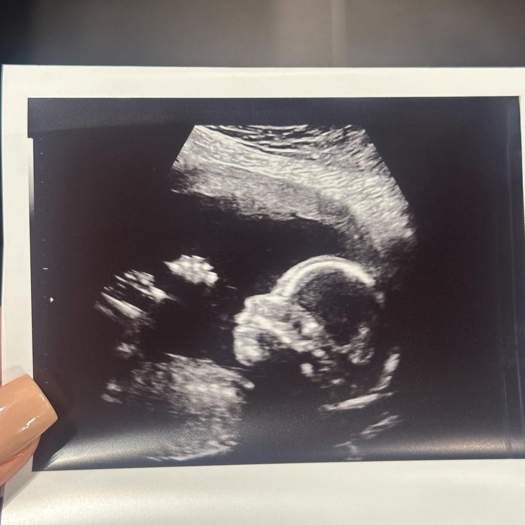 Ultraschallbild von Tamara Hitz' Baby