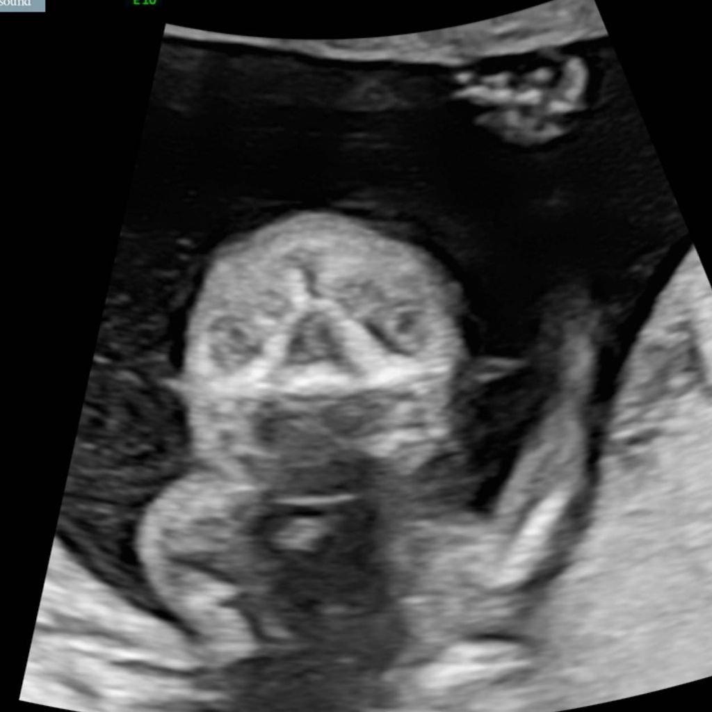 Whitney Cummings zeigt ein Ultraschallbild ihres Babys
