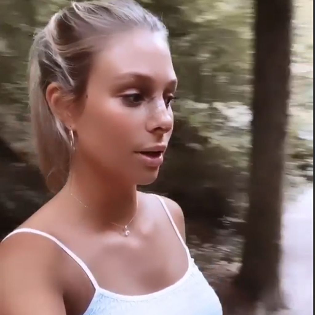Vanessa Schmitt nach ihrer Nasen-OP