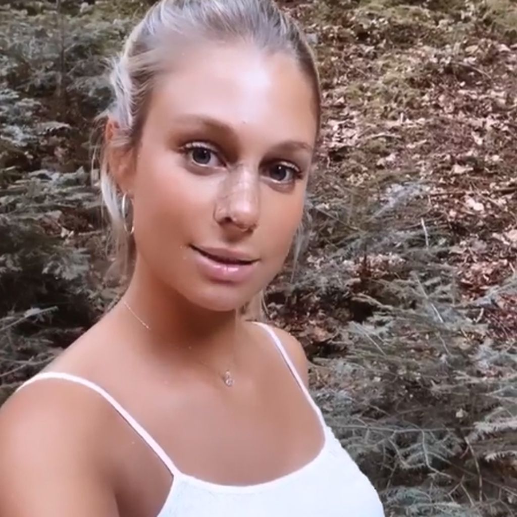 Vanessa Schmitt nach ihrer Nasen-OP