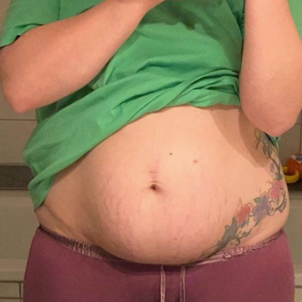 Vanessa Schneiders Bauch nach der Geburt, Dezember 2020