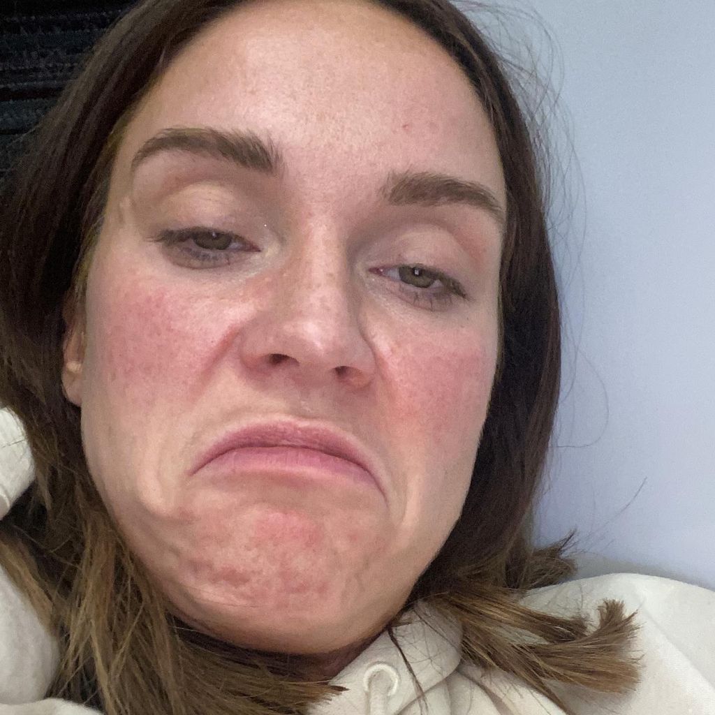 Vicky Pattison verzieht das Gesicht