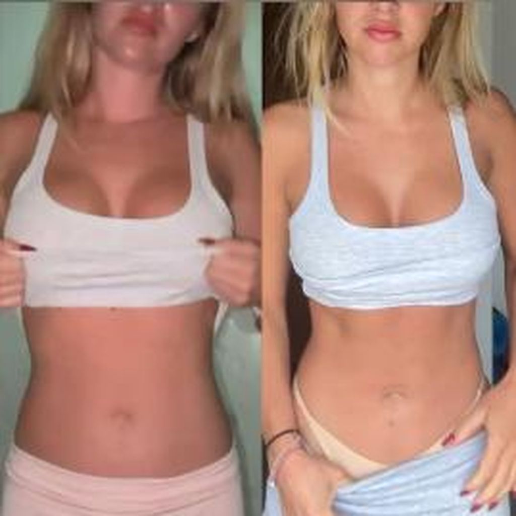 Vorher-Nachher-Bild von Emma Fernlund nach ihrem Wasserfasten