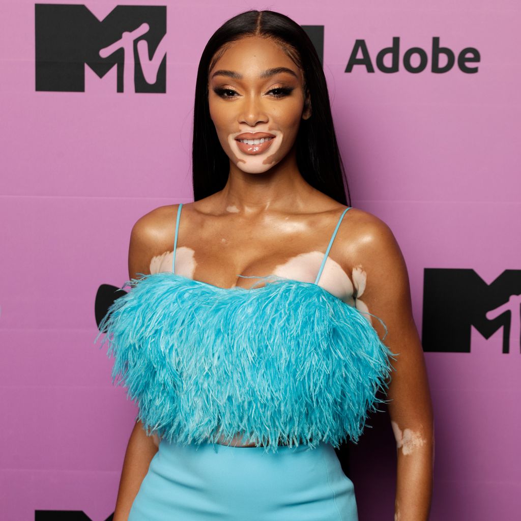 Model Winnie Harlow