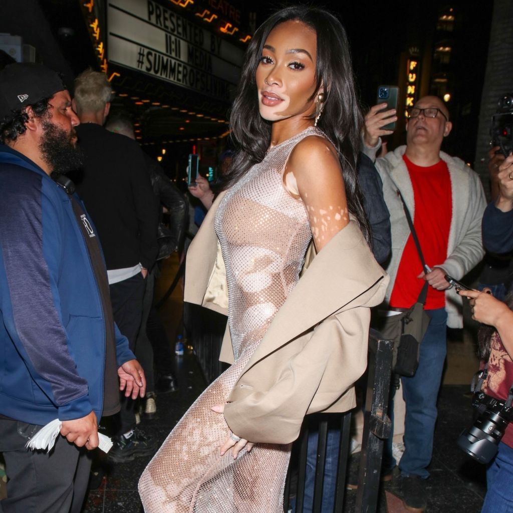 Winnie Harlow beim Paris-Hilton-Konzert in Hollywood