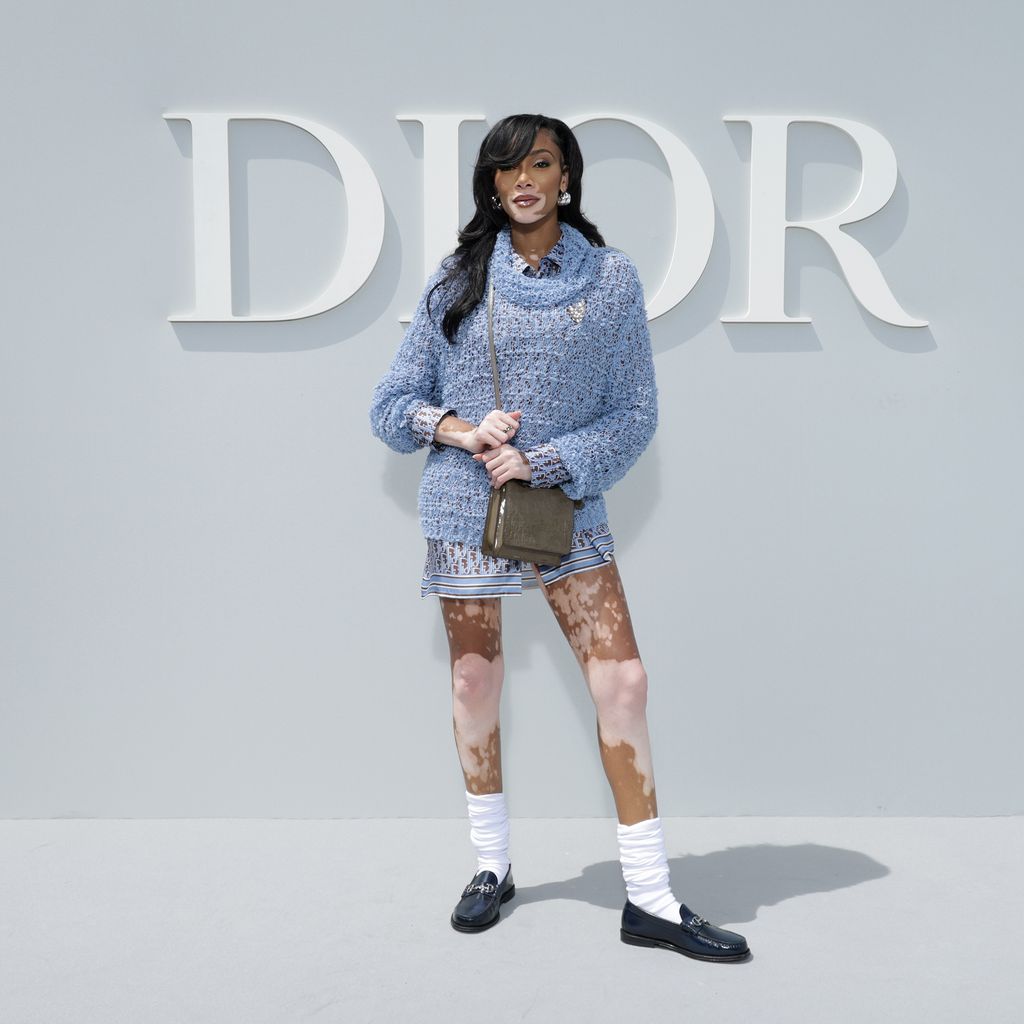 Winnie Harlow, Model